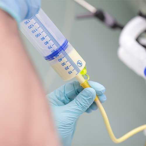 Enteral nutrition and the gut microbiome