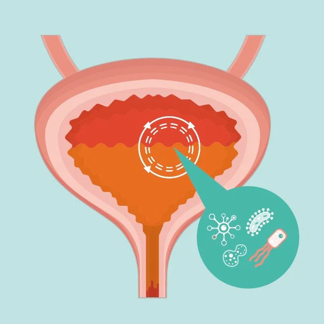Urinary tract infections in primary care: What's the evidence?